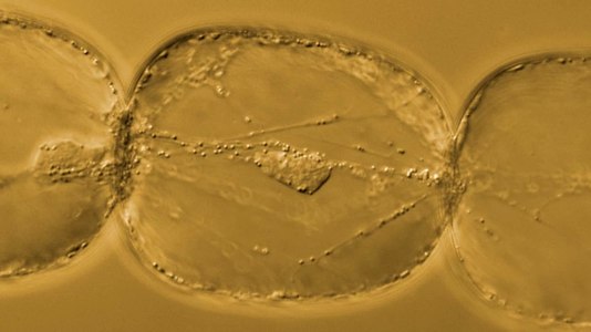 File:Movement of organelles in Tradescantia stamen hair cells.webm