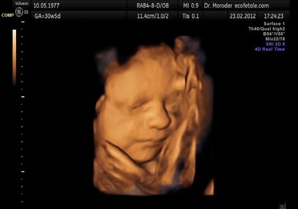 File:Fetal yawning 4D ultrasound ecografia 4D Dr. Wolfgang Moroder.theora.ogv